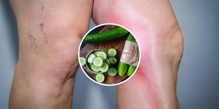 Reduz o inchaço e a retenção de líquidos - Créditos: depositphotos.com / maxskyohm27 / Créditos: depositphotos.com / Hriana