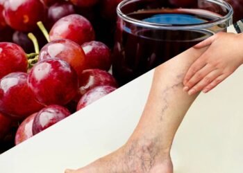 Essa bebida natural melhora a circulação e ainda ajuda a reduzir os riscos de varizes