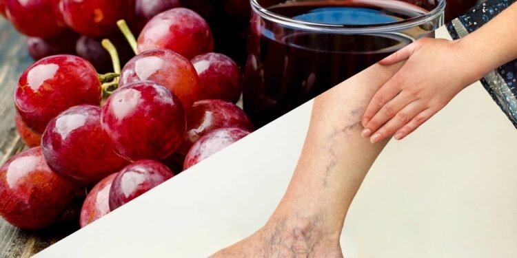 Essa bebida natural melhora a circulação e ainda ajuda a reduzir os riscos de varizes