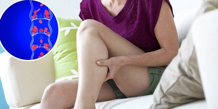 Esses sintomas de má circulação aparecem primeiro nas pernas e podem mudar sua pele