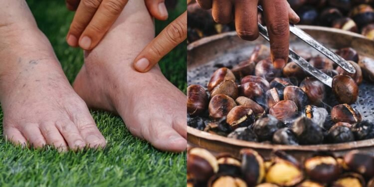 Além de fortalecer os vasos, a castanha-da-índia tem uma potente propriedade anti-inflamatória - Créditos: depositphotos.com / olegbreslavtsev / Créditos: depositphotos.com / toa55