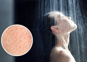 Tomar banho todos os dias nem sempre é saudável, segundo Harvard