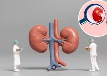 Como identificar sinais de sobrecarga nos rins antes de sintomas graves