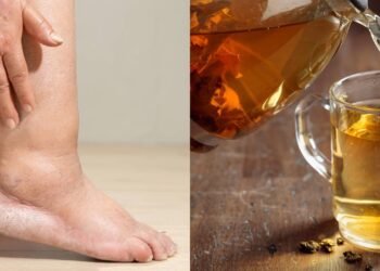 Chás que ajudam a reduzir o inchaço e aliviar a sensação de pernas pesadas