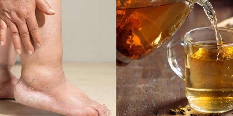 Diversas plantas possuem propriedades diuréticas e podem ser preparadas em chás terapêuticos - Créditos: depositphotos.com / toa55 / Créditos: depositphotos.com / igorr1