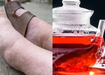 O chá mais indicado para combater o inchaço e a retenção de líquidos