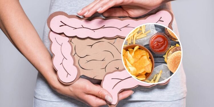 7 alimentos ultraprocessados que você deve evitar para reduzir risco de câncer de cólon