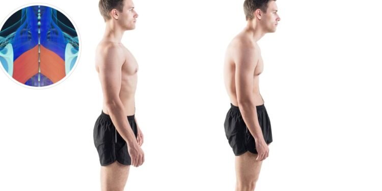 O músculo esquecido que melhora a postura quando fortalecido