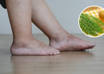 A planta que ajuda os rins e reduz aquela sensação de pernas cansadas