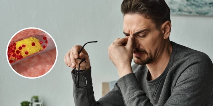 Sinais iniciais de colesterol alto que aparecem na rotina diária