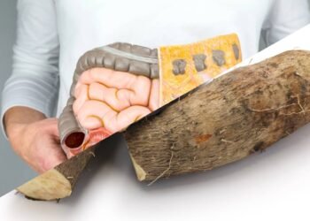 Como o amido resistente deste alimento melhora o funcionamento do seu intestino