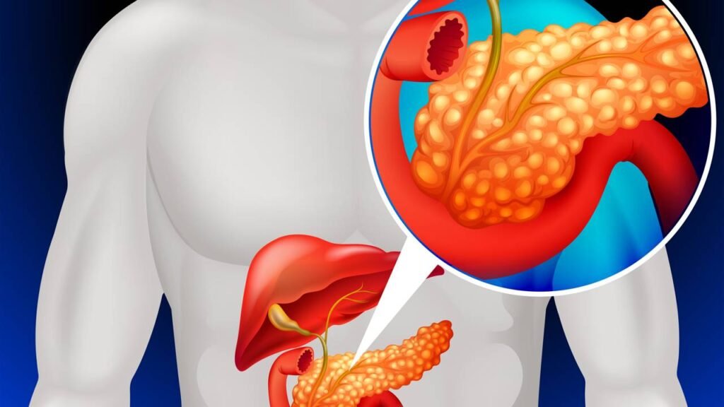 Saiba como detetar os primeiros sinais do (silencioso) câncer do pâncreas