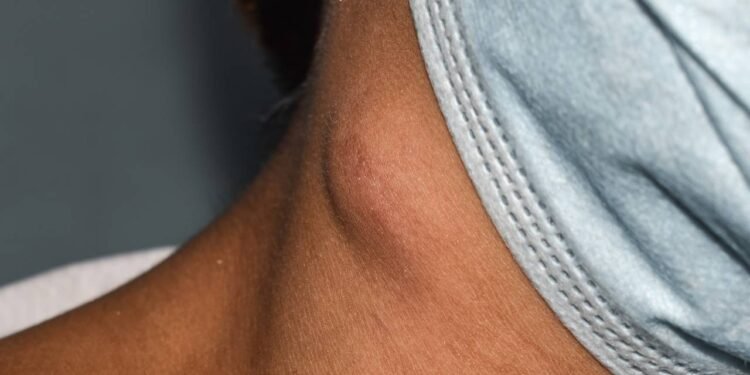 Ínguas - Créditos: depositphotos.com / zaynyinyi