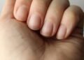 O que unhas amarelas dizem sobre sua saúde?
