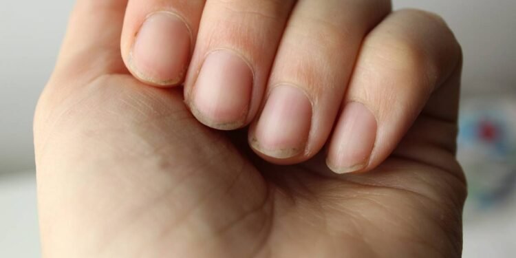 unhas amarela - Créditos: depositphotos.com / LyaNevada