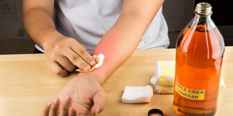 Muitos adeptos do uso tradicional acreditam que o vinagre de maçã pode melhorar significativamente o processo digestivo - Créditos: depositphotos.com / Thamkc