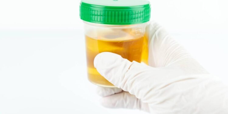 O que a cor do seu xixi revela silenciosamente sobre você, segundo especialistas