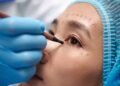 Dra. Najla Smaili: A blefaroplastia sem corte que promete surpreender