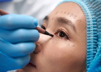 Dra. Najla Smaili: A blefaroplastia sem corte que promete surpreender