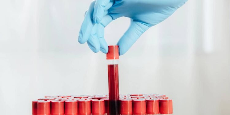 Exame de Sangue - Créditos: depositphotos.com / MicEnin