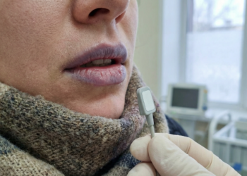 Por que o frio deixa os lábios roxos?