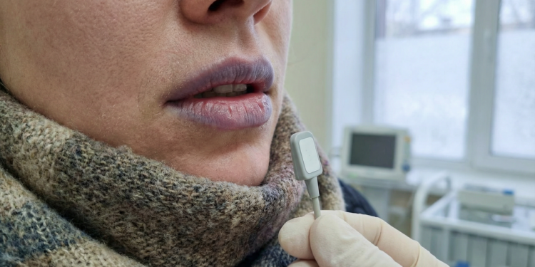 Por que o frio deixa os lábios roxos?