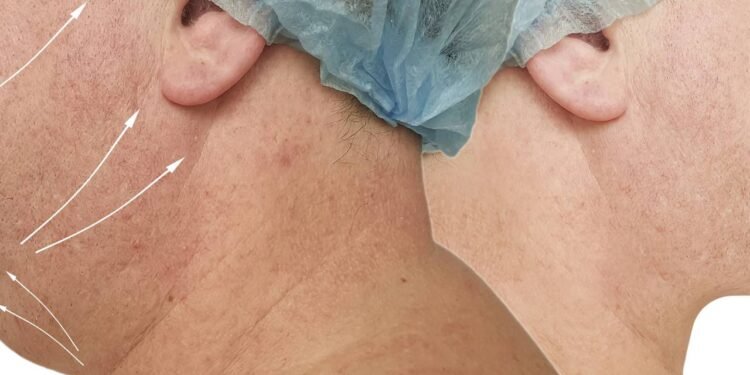 Procedimentos Estéticos Masculinos - Créditos: depositphotos.com / TanyaLovus