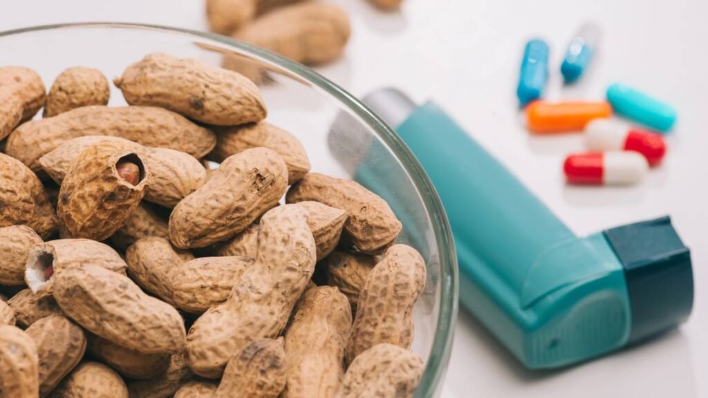 Comer este fruto seco todos os dias ajuda a fortalecer o cérebro