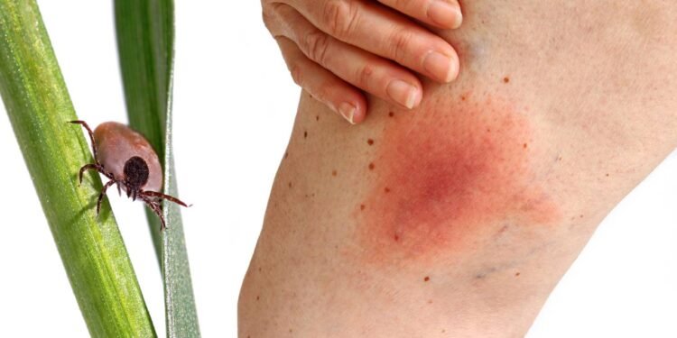 Assadura - Créditos: depositphotos.com / astrid208