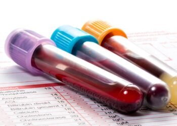 Um exame de sangue pode revelar sua chance de morrer na próxima década?