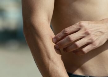 Por que sentimos coceira quando alguém fala de piolhos ou mosquitos segundo especialistas