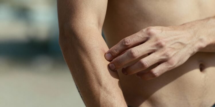 Por que sentimos coceira quando alguém fala de piolhos ou mosquitos segundo especialistas