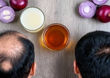 O suco de cebola crua que regenera falhas no cabelo rapidamente: como o enxofre acorda os folículos