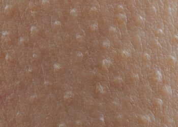 Se você sente arrepios ao ouvir certas músicas, isso tem uma explicação poderosa