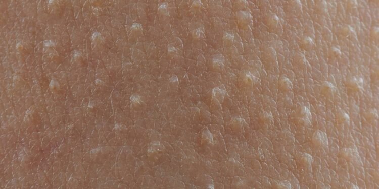 Se você sente arrepios ao ouvir certas músicas, isso tem uma explicação poderosa