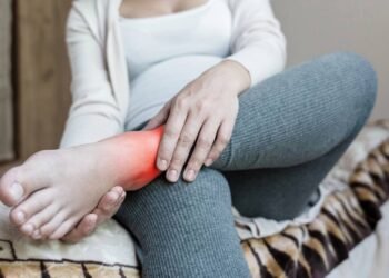 O que fazer quando as pernas incham ao ficar muito tempo sentado?