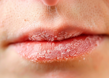 Por que ficamos com a boca seca quando estamos nervosos?