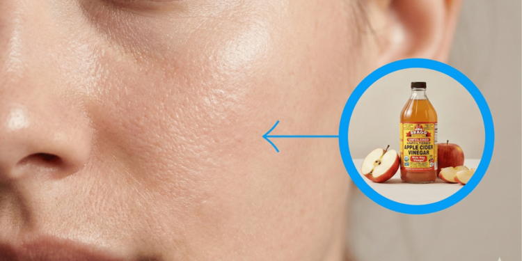 Nem ervas, nem cremes: o item de cozinha comum que todos têm em casa e pode ser usado para cuidar da pele sem gastar nada