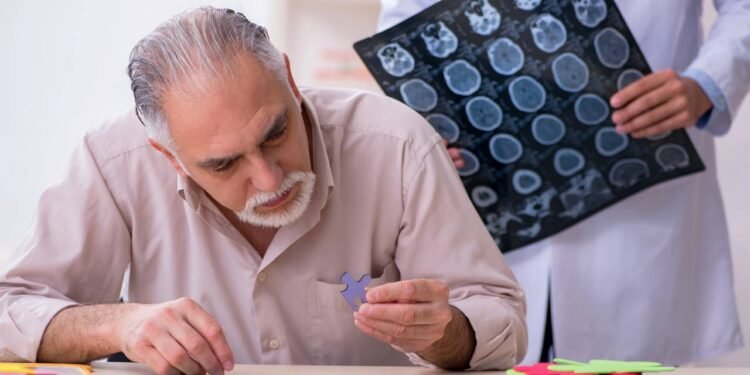 Os sinais inofensivos que apontam um começo silencioso do Alzheimer