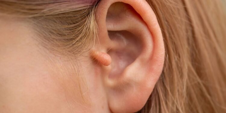 Malformação de Orelha - Créditos: depositphotos.com / Nastyaofly