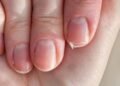 O erro diário que enfraquece as unhas sem perceber