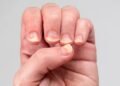 O erro diário que enfraquece as unhas sem perceber