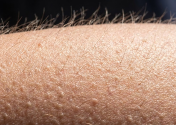 O que acontece no corpo quando a pele se arrepia ao sentir emoções?