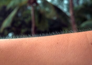 Você se arrepia quando escuta uma música? Isso te torna mais raro do que você imagina