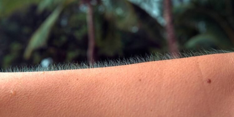 Você se arrepia quando escuta uma música? Isso te torna mais raro do que você imagina