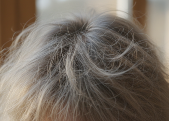 Por que o cabelo arrepia quando está muito seco?