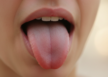 O que a cor da língua pode indicar sobre sua saúde digestiva