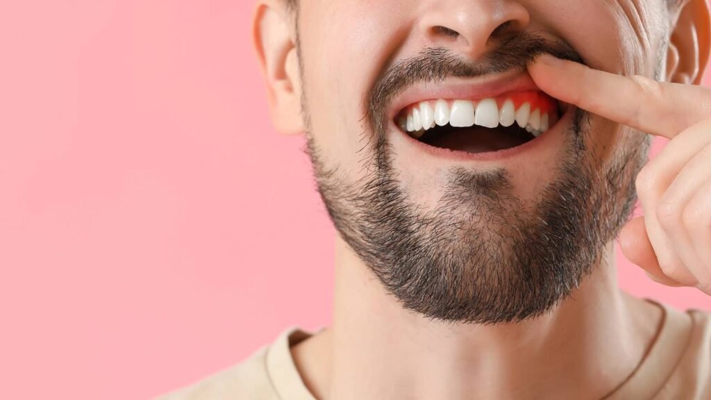 O que acontece quando a gengiva está vermelha e inchada e por que isso não deve ser ignorado