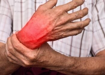 A estratégia mais eficaz para controlar artrite