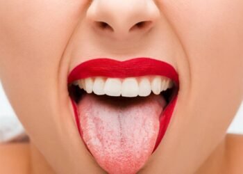 Quando a língua branca deixa de ser normal e exige atenção